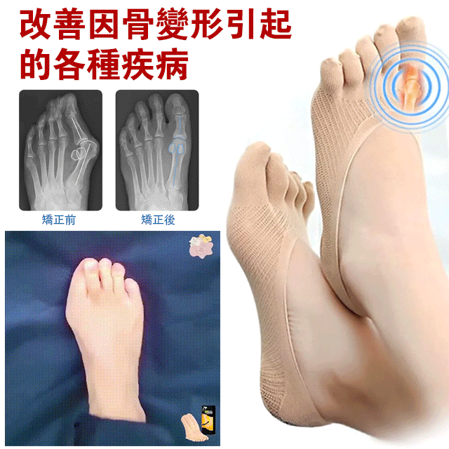 買六送六 消腫緩痛五指襪  免運費 七天鑑賞期  買六送六 消腫緩痛五指襪  免運費 七天鑑賞期